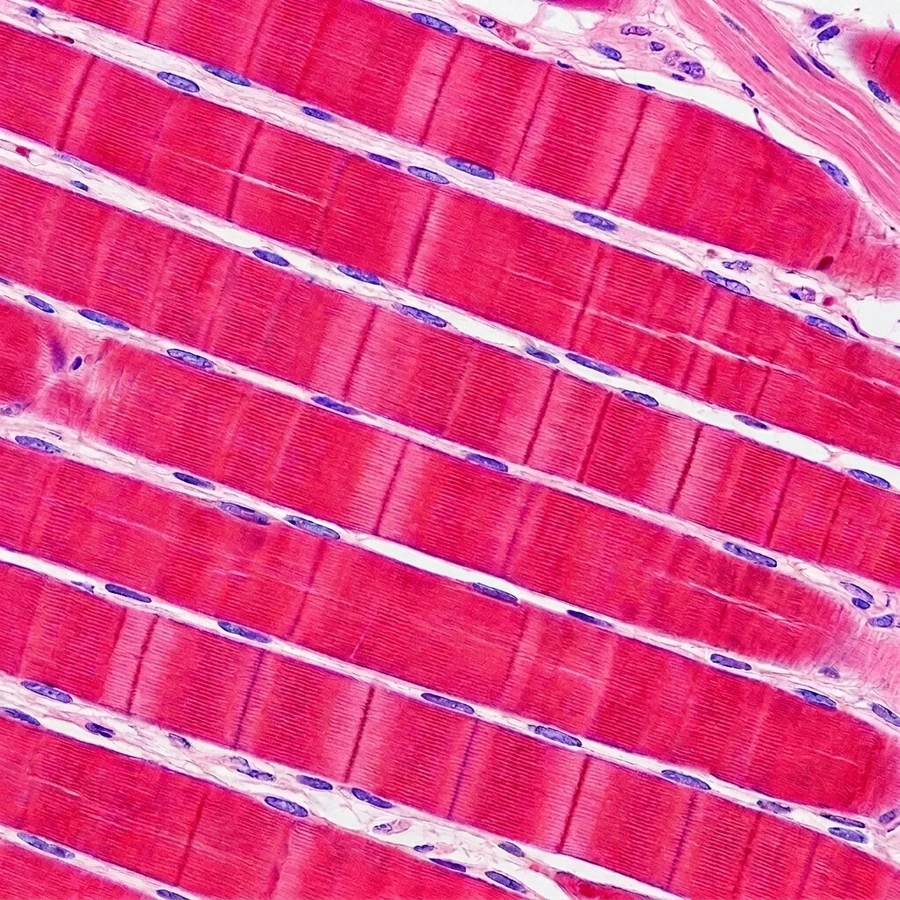 Músculo estriado esquelético al microscopio