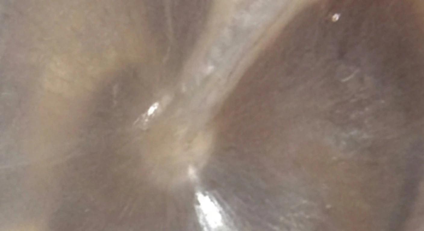 Otoscopia y orofaringoscopia: Mango del martillo y cono de luz (detalle)