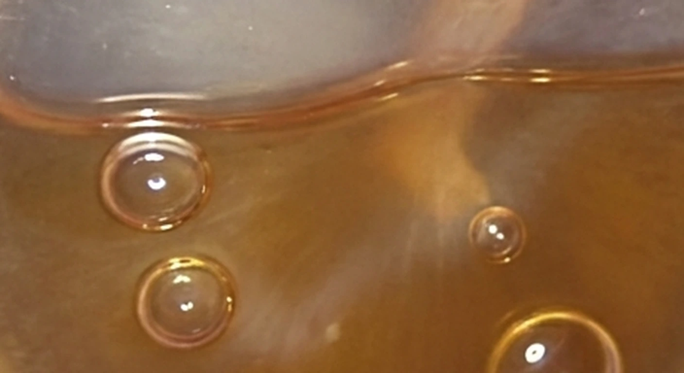Otoscopia y orofaringoscopia: Nivel hidroaéreo y burbujas (detalle)